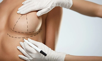 Chirurgie mammaire